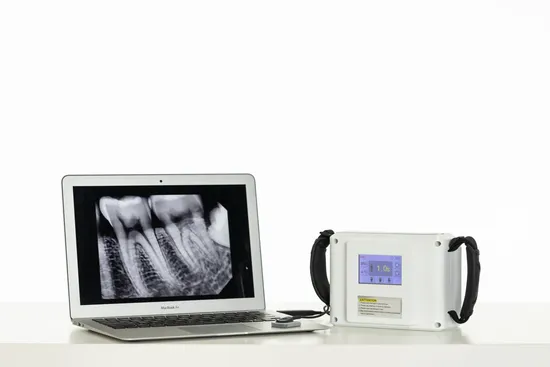 Dental Equipment Plus Handheld Portable X Ray Unit